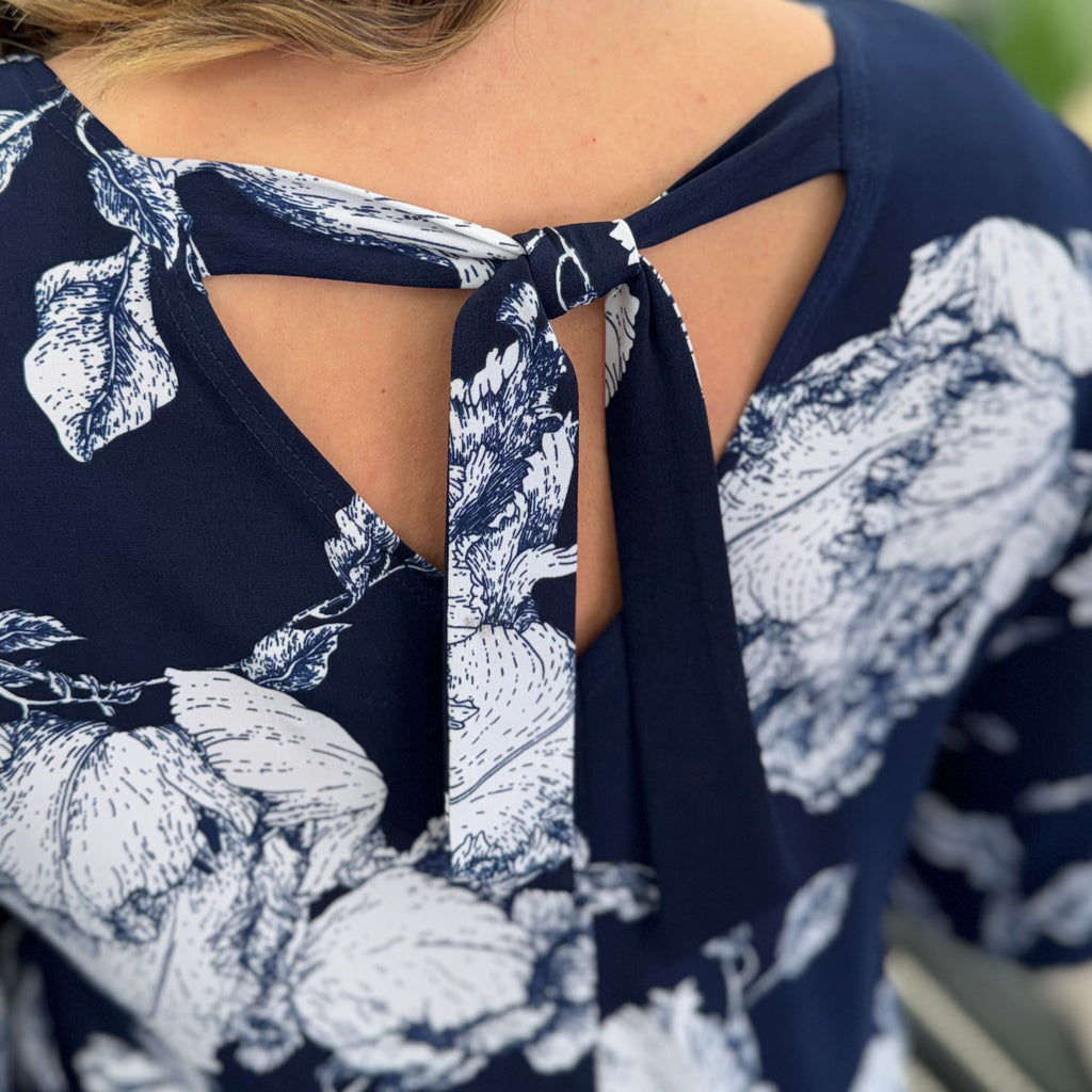 Peony Blossom Tulip Cuff Back Tie Dress